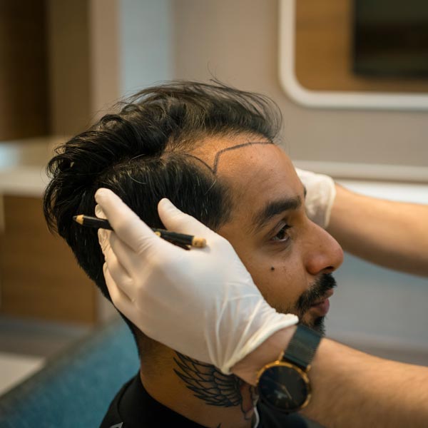 man during hair transplant consultation